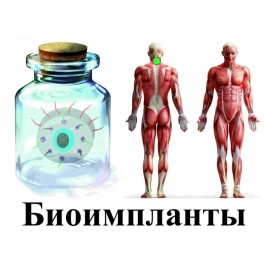 Видеосистема - Биоимпланты